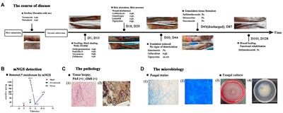 Severe skin and subcutaneous pythiosis in China: Metagenomic identification and characterization of Pythium insidiosum